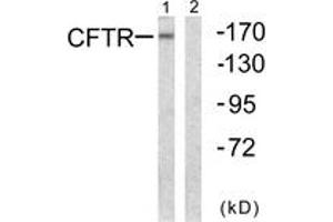 Image no. 1 for anti-Cystic Fibrosis Transmembrane Conductance Regulator (ATP-Binding Cassette Sub-Family C, Member 7) (CFTR) (AA 711-760) antibody (ABIN1532569)