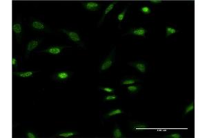 Image no. 3 for anti-Oligodendrocyte Lineage Transcription Factor 2 (OLIG2) (AA 2-78) antibody (ABIN523612)