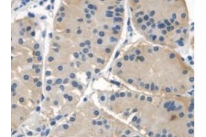 Image no. 3 for anti-NLR Family, Apoptosis Inhibitory Protein (NAIP) (AA 923-1148) antibody (ABIN1869394)