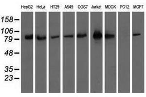 Image no. 2 for anti-Oxysterol Binding Protein-Like 11 (OSBPL11) antibody (ABIN1499922)
