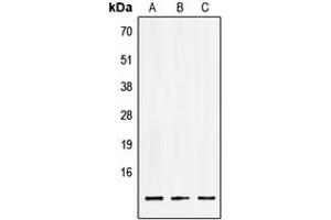 Image no. 1 for anti-LSM2 Homolog, U6 Small Nuclear RNA Associated (LSM2) (Center) antibody (ABIN2706488)