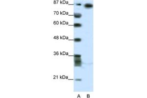 Image no. 1 for anti-Myoneurin (MYNN) antibody (ABIN2460663)
