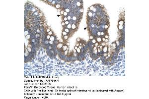 Image no. 1 for anti-Transcription Factor B2, Mitochondrial (TFB2M) (N-Term) antibody (ABIN2775816)