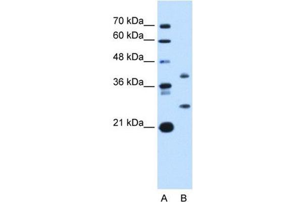 ST8SIA2 anticorps  (C-Term)