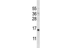 Image no. 1 for anti-Parathyroid Hormone (PTH) (AA 59-88) antibody (ABIN3028915)