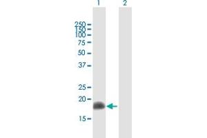 Western Blot analysis of ARL2 expression in transfected 293T cell line by ARL2 MaxPab polyclonal antibody.