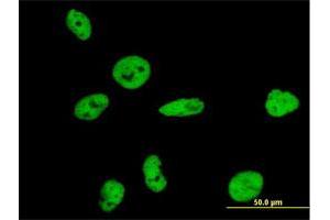 Image no. 4 for anti-Nuclear Mitotic Apparatus Protein 1 (NUMA1) (AA 1-1193) antibody (ABIN1327330)