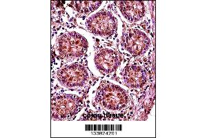 Image no. 1 for anti-Structural Maintenance of Chromosomes 1B (SMC1B) (Center) antibody (ABIN2503106)