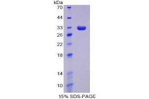 Image no. 1 for DNA (Cytosine-5)-Methyltransferase 1 (DNMT1) (AA 1343-1570) protein (His tag,T7 tag) (ABIN1878465)