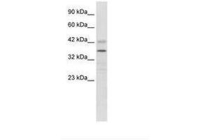 PRR7 antibody  (AA 160-209)