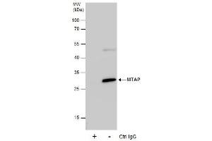 Image no. 3 for anti-Methylthioadenosine phosphorylase (MTAP) (full length) antibody (ABIN2856653)