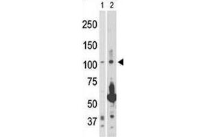 Image no. 2 for anti-Mitogen-Activated Protein Kinase Kinase Kinase 14 (MAP3K14) (AA 119-148) antibody (ABIN3031848)