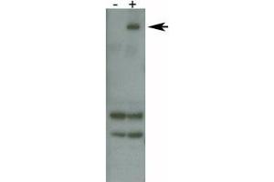 Image no. 4 for anti-Leucine-Rich Repeat Kinase 2 (LRRK2) (AA 878-909) antibody (ABIN3031607)