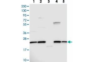Image no. 1 for anti-Neuropeptide VF Precursor (NPVF) antibody (ABIN5584693)