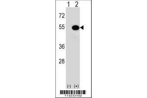 Image no. 2 for anti-Mitogen-Activated Protein Kinase-Activated Protein Kinase 5 (MAPKAPK5) (AA 160-189) antibody (ABIN391320)