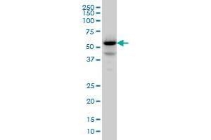 Image no. 1 for anti-Protein Phosphatase 1F (PP2C Domain Containing) (PPM1F) (AA 1-100) antibody (ABIN564170)