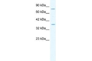 Image no. 1 for anti-Minichromosome Maintenance Deficient 4 (MCM4) (Middle Region) antibody (ABIN630173)