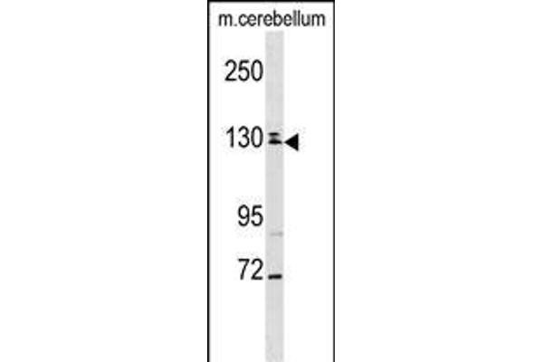 TBC1D8 抗体  (C-Term)