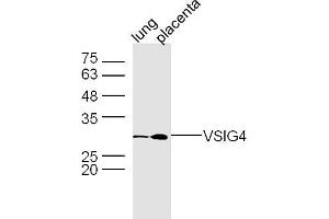 Image no. 2 for anti-V-Set and Immunoglobulin Domain-Containing Protein 4 (VSIG4) (AA 81-160) antibody (ABIN669111)