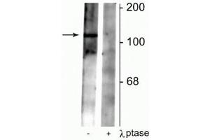 Image no. 2 for anti-gamma-aminobutyric Acid (GABA) B Receptor, 2 (GABBR2) (pSer783) antibody (ABIN361471)