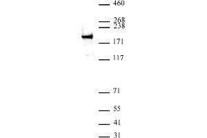 Image no. 1 for anti-Zinc Finger E-Box Binding Homeobox 1 (ZEB1) (N-Term) antibody (ABIN6972920)