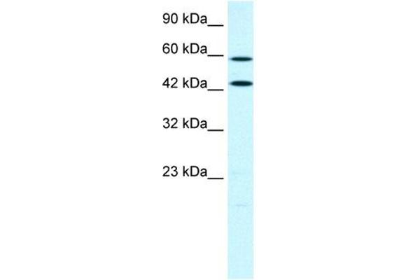 ACSL1 anticorps  (C-Term)