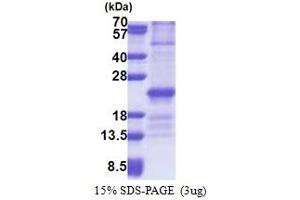 Image no. 1 for Zinc Finger, HIT-Type Containing 3 (ZNHIT3) (AA 1-155) protein (His tag) (ABIN5853239)