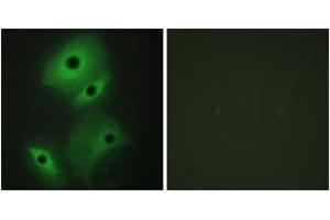 Image no. 3 for anti-Neuroblastoma 1, DAN Family BMP Antagonist (NBL1) (AA 131-180) antibody (ABIN1533727)