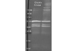 Image no. 1 for anti-Glycerol Kinase (GK) antibody (ABIN99891)
