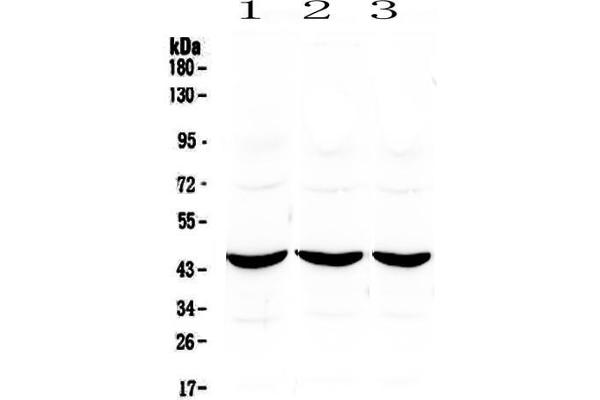 anti-Adenosine Deaminase (ADA) (AA 2-238) antibody