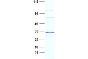 Image no. 1 for ATP-Binding Cassette, Sub-Family B (MDR/TAP), Member 1 (ABCB1) protein (DYKDDDDK Tag) (ABIN2713531)