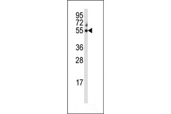 CYP3A5 Antikörper  (C-Term)