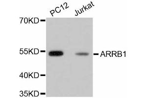 Image no. 8 for anti-Arrestin, beta 1 (ARRB1) antibody (ABIN4903044)