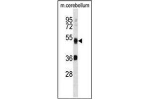 Image no. 4 for anti-Autophagy related 4B Cysteine Peptidase (ATG4B) (AA 23-53), (N-Term) antibody (ABIN1449637)
