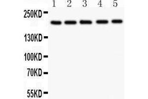 Image no. 4 for anti-Tuberous Sclerosis 2 (TSC2) (AA 1611-1807) antibody (ABIN3043498)