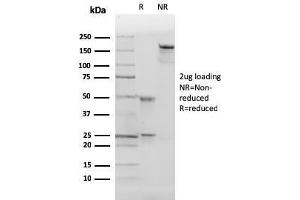 Image no. 1 for anti-Cyclin-Dependent Kinase Inhibitor 1B (p27, Kip1) (CDKN1B) antibody (ABIN6939044)