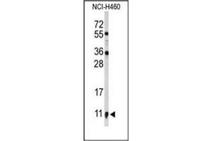 Image no. 1 for anti-S100 Calcium Binding Protein A10 (S100A10) (AA 19-48), (Middle Region) antibody (ABIN954651)