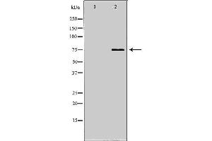 Image no. 2 for anti-NDC80 Kinetochore Complex Component Homolog (NDC80) antibody (ABIN6263548)