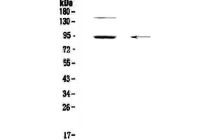 Image no. 1 for anti-phosphodiesterase 4D, cAMP-Specific (PDE4D) (AA 466-709) antibody (ABIN5693278)