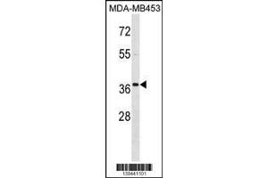 Image no. 2 for anti-Mesenchyme Homeobox 2 (MEOX2) (AA 164-192) antibody (ABIN1537918)