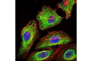 Figure 3: Immunofluorescence analysis of HeLa cells using GPC3 mouse mAb (green) .