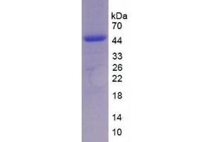 IL-17 Protein
