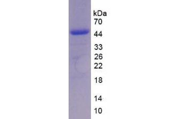 IL-17 Protein