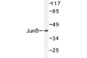Image no. 1 for anti-Jun B Proto-Oncogene (JUNB) antibody (ABIN265489)