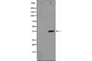 Image no. 11 for anti-Nuclear Factor of kappa Light Polypeptide Gene Enhancer in B-Cells Inhibitor, alpha (NFKBIA) (pSer32), (pSer36) antibody (ABIN6256292)