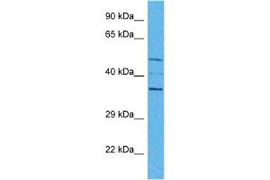 Image no. 2 for anti-Proximal Sequence Element 1 (SPDEF) (Middle Region) antibody (ABIN2779703)
