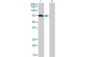 Image no. 5 for anti-A Kinase (PRKA) Anchor Protein 10 (AKAP10) (AA 1-100) antibody (ABIN564879)