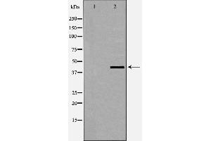 Image no. 2 for anti-erythrocyte Membrane Protein Band 4.9 (Dematin) (EPB49) (pSer403) antibody (ABIN6255309)