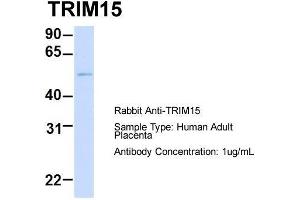 Image no. 2 for anti-Tripartite Motif Containing 15 (TRIM15) (Middle Region) antibody (ABIN2787564)