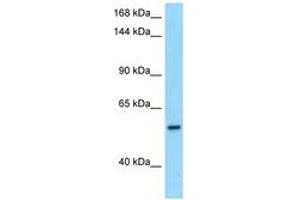 Image no. 1 for anti-phosphodiesterase 6B, CGMP-Specific, Rod, beta (PDE6B) (AA 105-154) antibody (ABIN6748131)